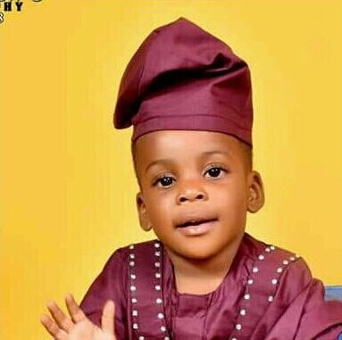 Urgente operazione chirurgica per il piccolo Michael Nicholas affetto da tumore maligno all'occhio