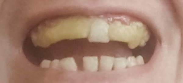 Oltre il dolore: la rinascita che parte da un sorriso